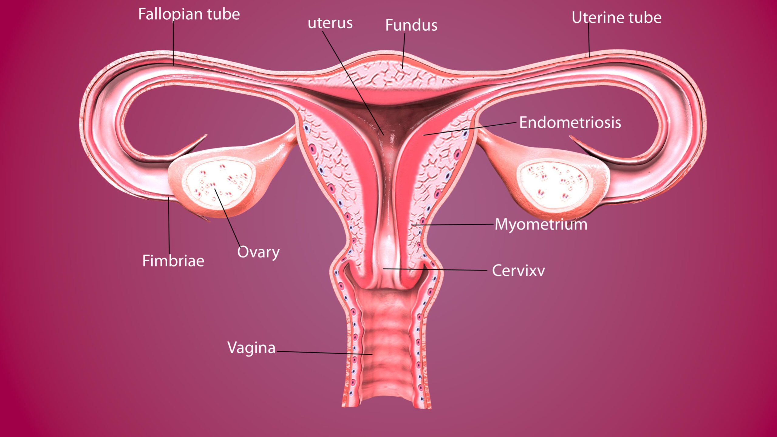 gynae